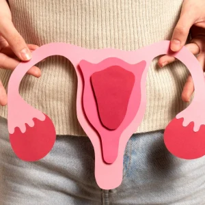 دوره آموزشی درمان سندرم تخمدان پلی‌کیستیک