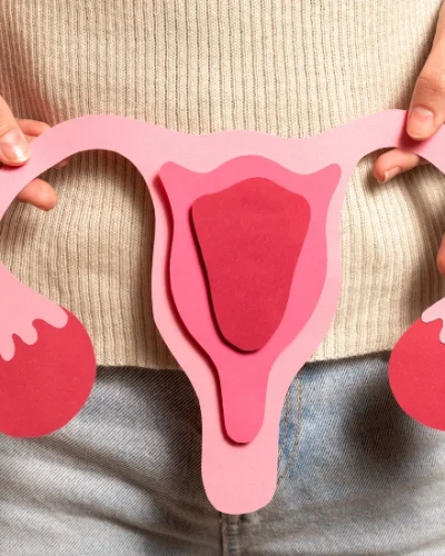 Polycystic-ovary-syndrome1