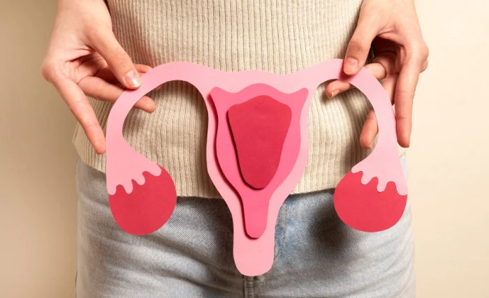 Polycystic-ovary-syndrome1